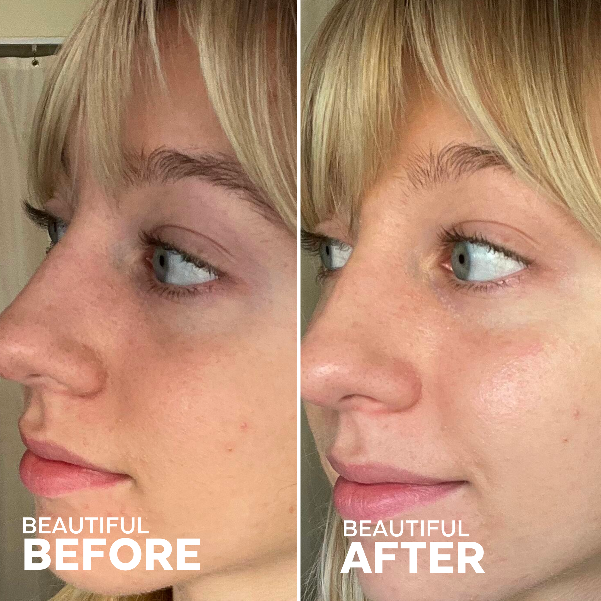 Patchs biodégradables pour les yeux aux algues et à l'avocat | Brighter Days