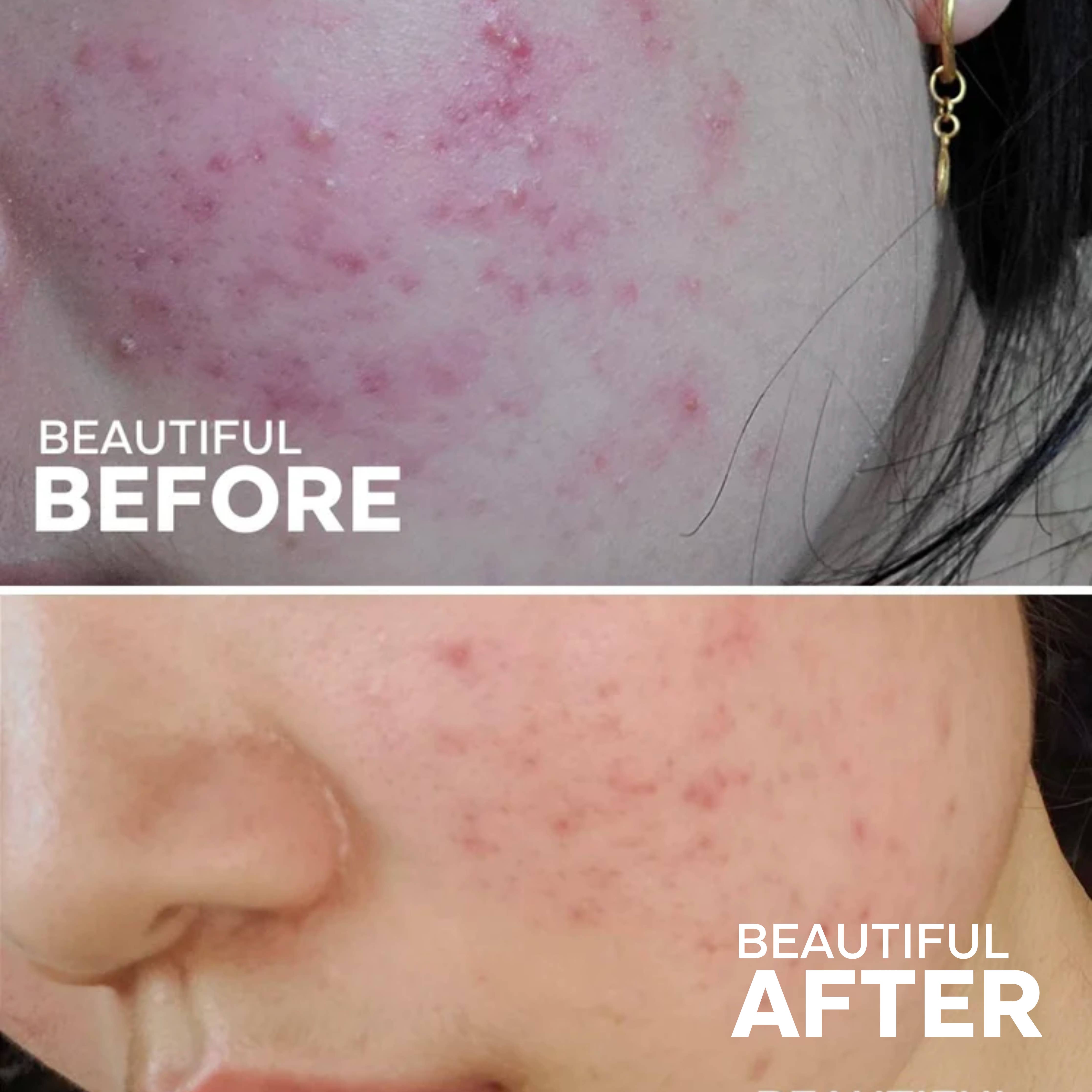 Masque antioxydant à l'argile au thé vert | Detox