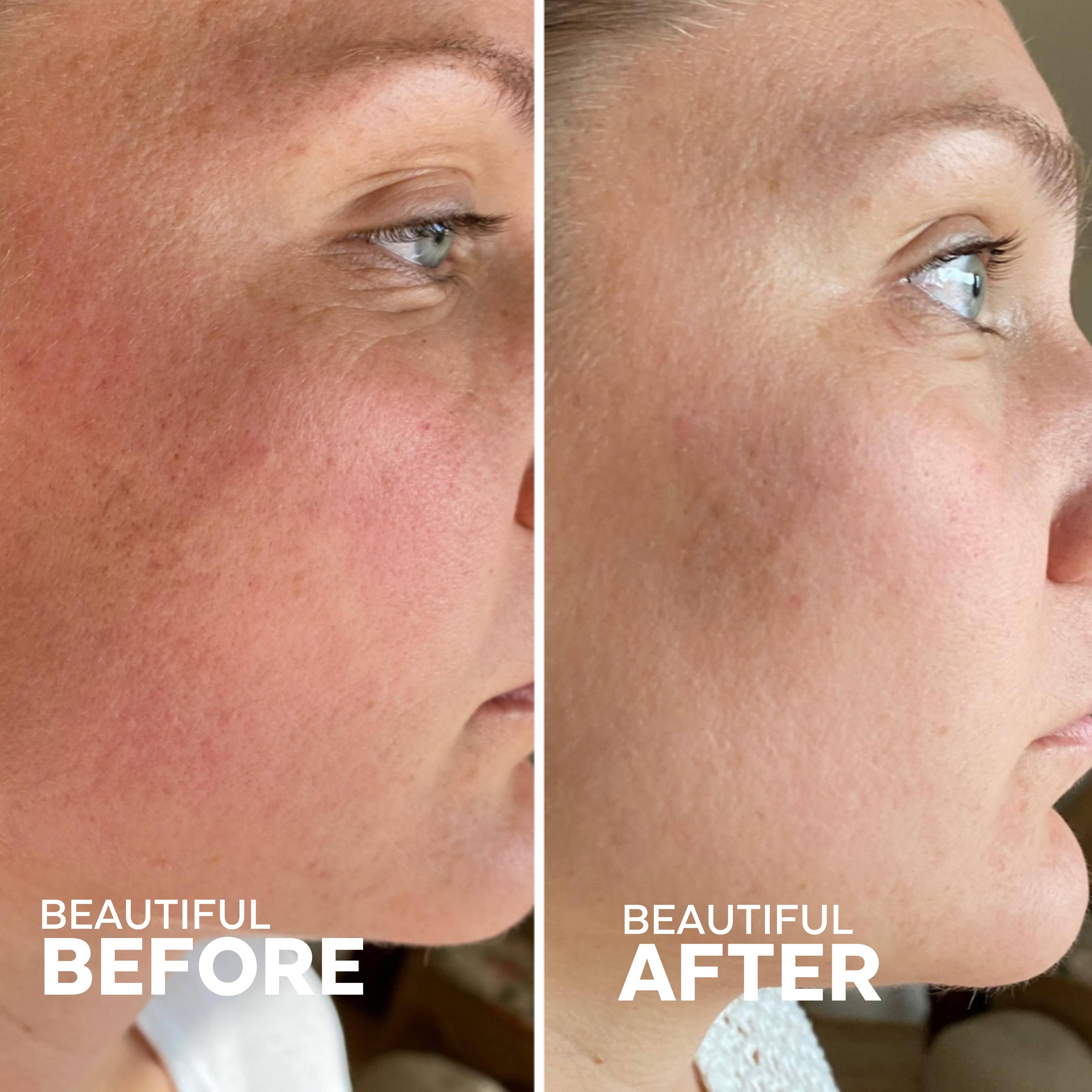 Sérum biorétinol au calendula + 2% Bakuchiol | Skin Hero