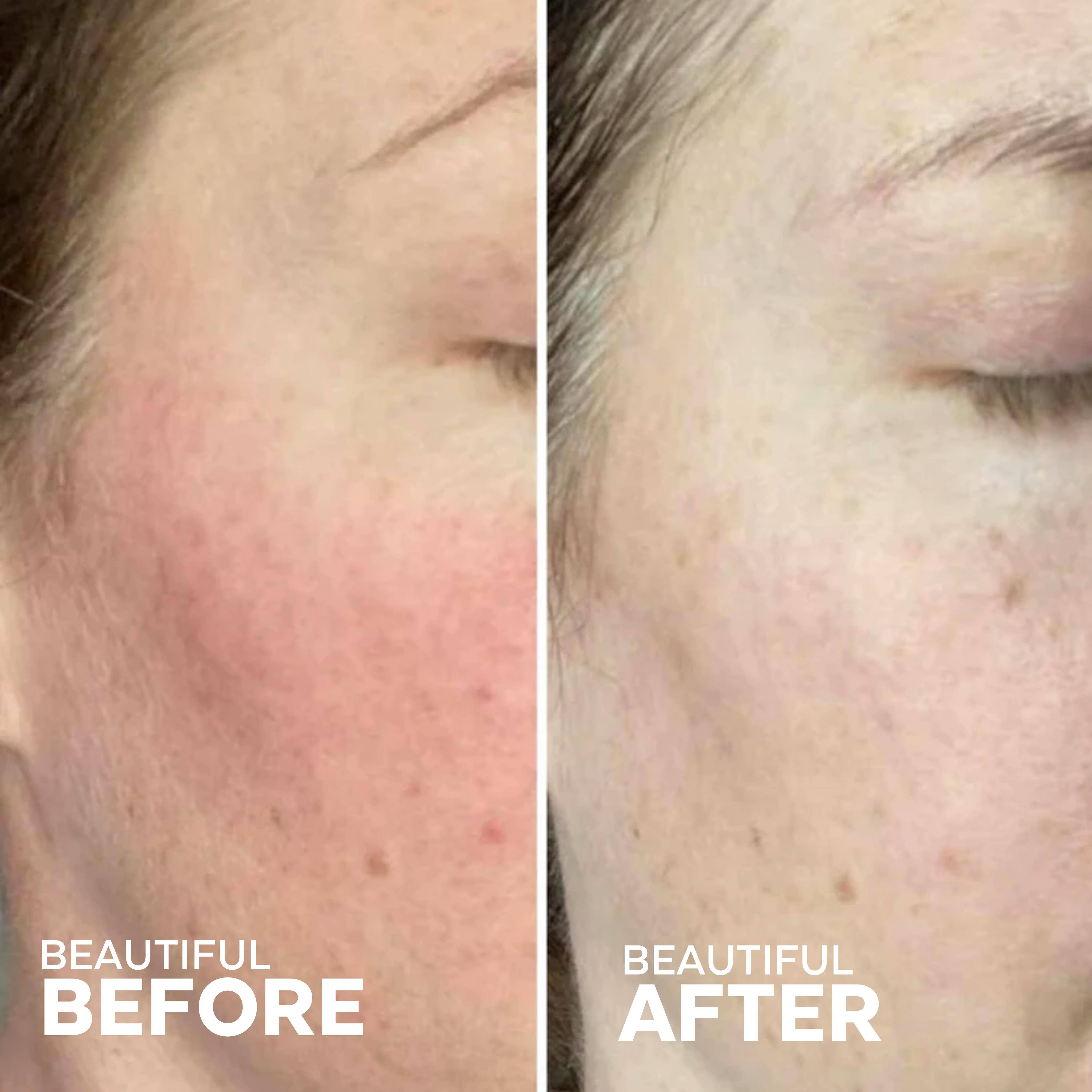 Lavender Hydrosol Toner | Calm