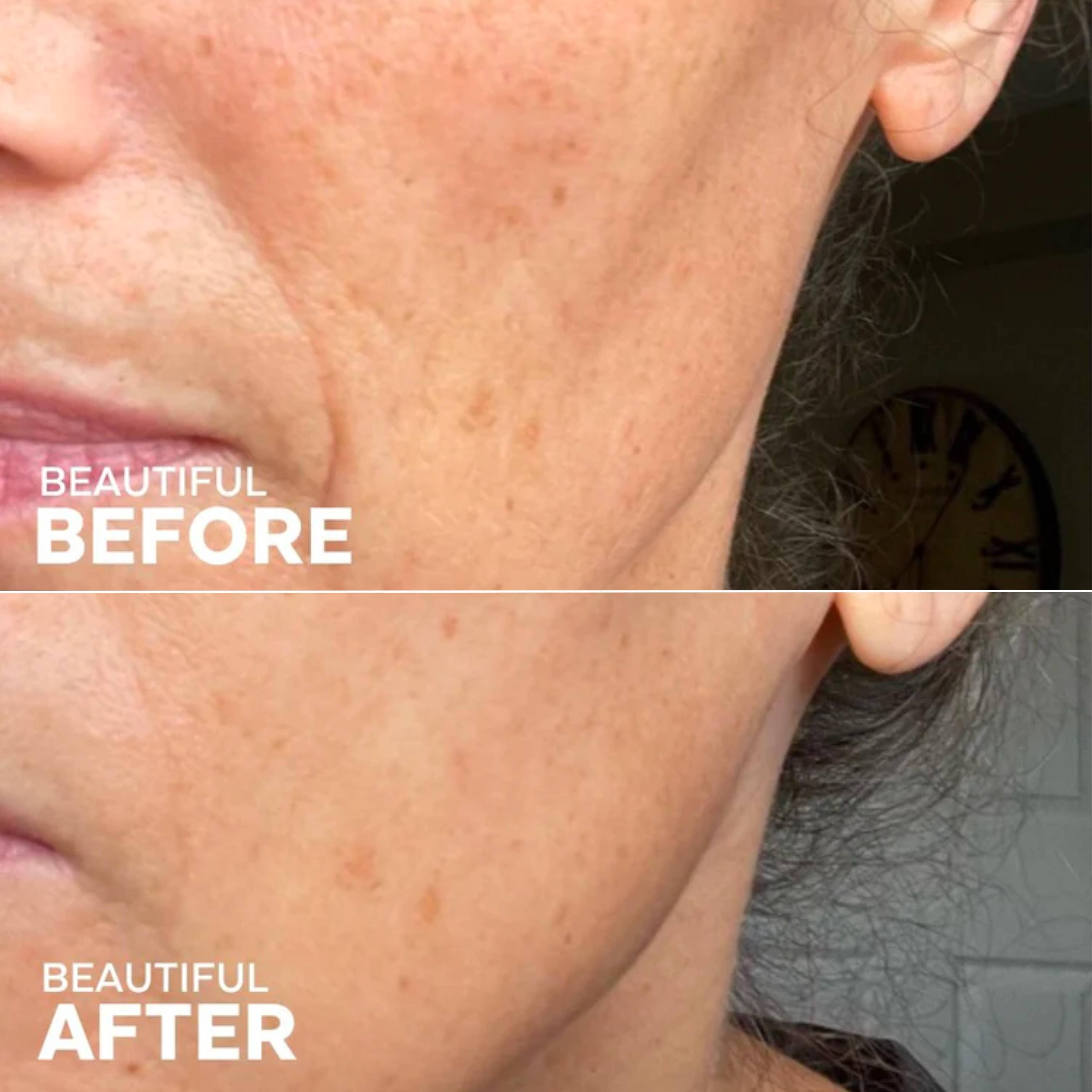 Sérum à l'huile de rose musquée 49 % | Boost