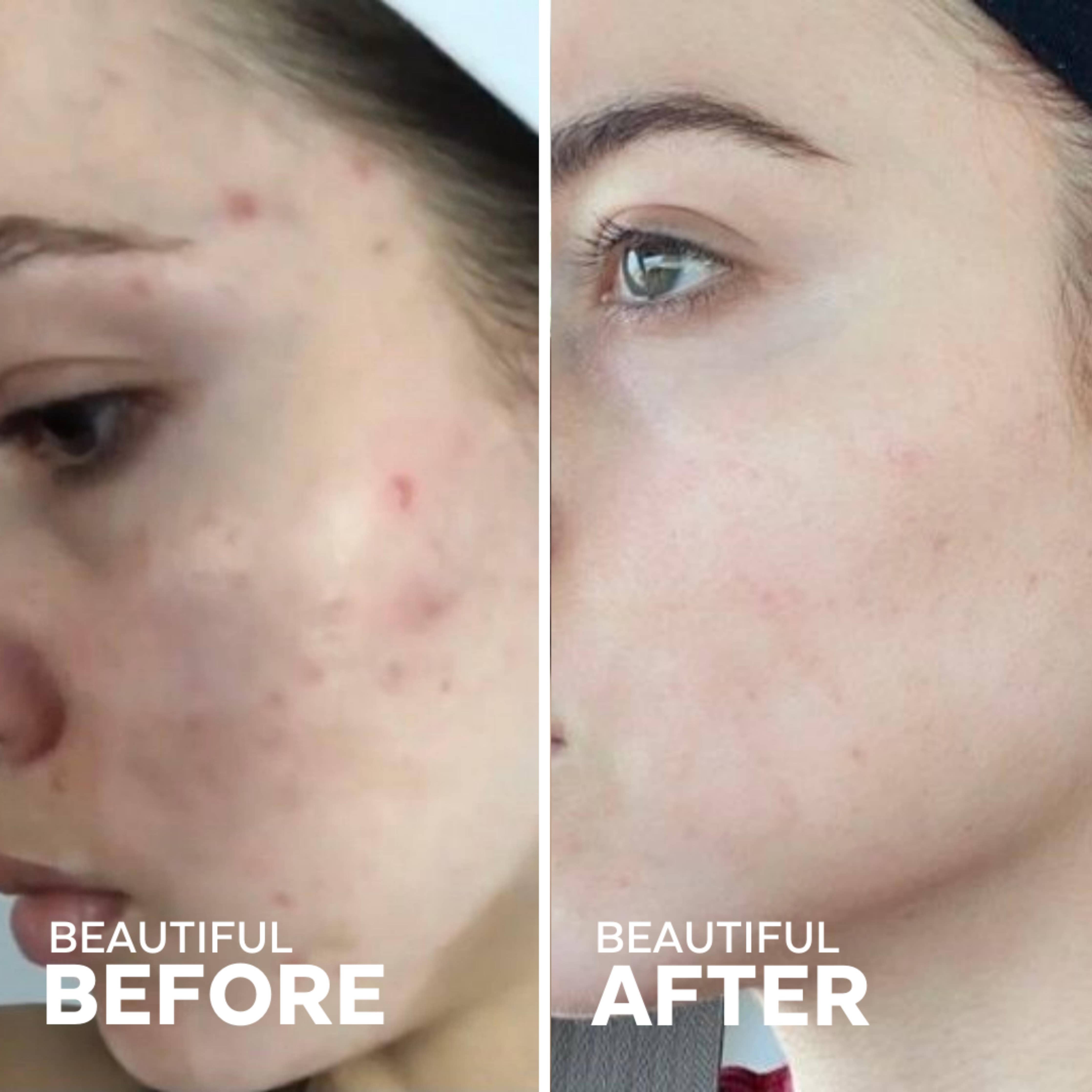 Sérum à l'acide hyaluronique et à la vitamine C | Dew Drops aux champignons