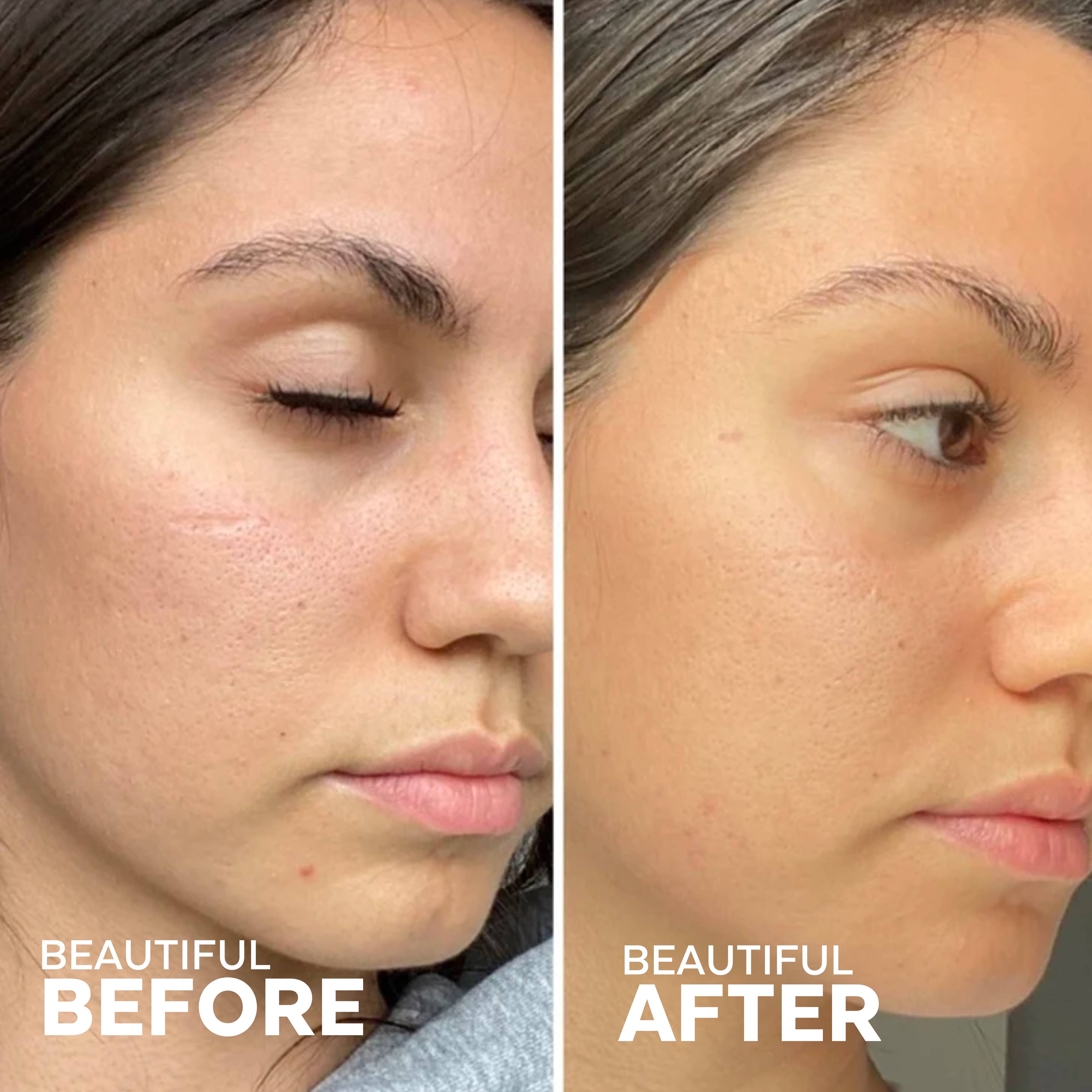 Sérum à l'huile de jojoba 49 % | Glow